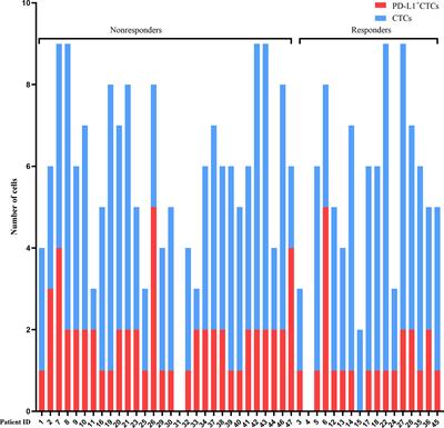 PD-L1 expression on circulating tumor cells can be a predictive biomarker to PD-1 inhibitors combined with radiotherapy and antiangiogenic therapy in advanced hepatocellular carcinoma